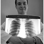 Польза и вред рентгеновских лучей