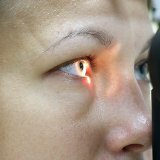 Причины заболевания глаз глаукомы