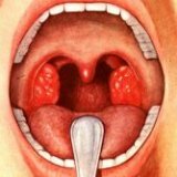 Роль лимфатических структур в горле