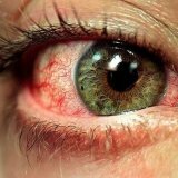 Как влияют общие заболевания на орган зрения