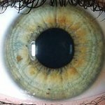 Диагностика заболеваний по радужке глаз