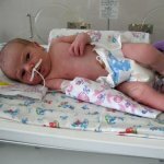 Лечение пневмонии у новорожденных и месячных детей