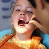 Профилактика кариеса на постоянных зубах у детей