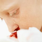 Почему у детей идет из носа кровь
