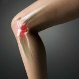 Народные методы лечения артроза коленного сустава