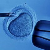 Экстракорпоральное оплодотворение яйцеклетки женщины