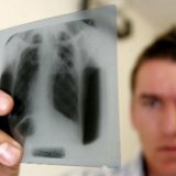 Лечебные и профилактические меры при туберкулёзе
