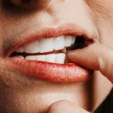Причины подвижности зубов человека