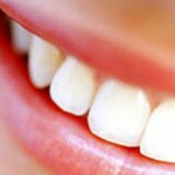 Распространенные заблуждения о здоровье зубов
