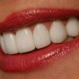 Тщательное отбеливание зубов у человека
