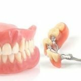 Методы протезирования зубов человека