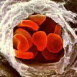Норма гемоглобина и последствия его изменения