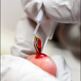 Расшифровывание общего анализа крови