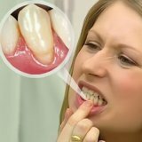 Профилактика заболеваний зубов народными средствами